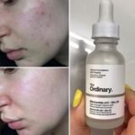 The Ordinary Niacinamide 10% + Zinc 1% Serum | 30ml - Image 6