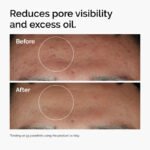The Ordinary Niacinamide 10% + Zinc 1% Serum | 30ml - Image 9